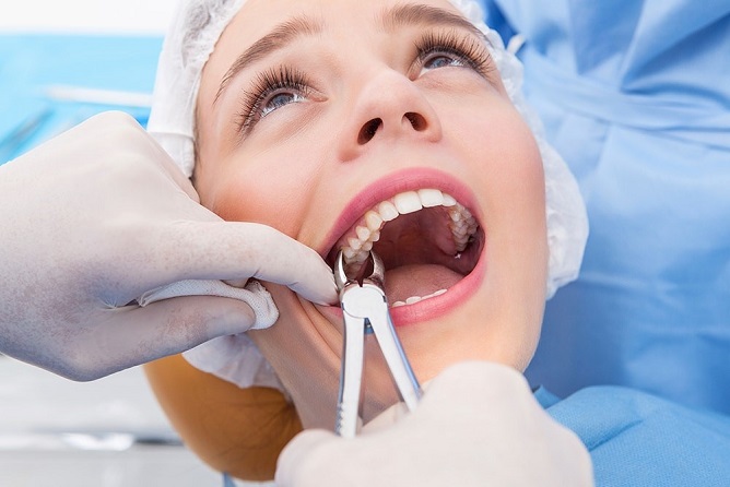 چرا جراحی دندان عقل امروزه یک جراحی رایج است؟